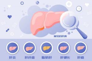 各类肝病示意图